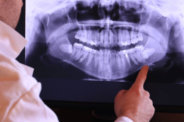 Best Broken Tooth Emergency  in Choctaw Lake, OH