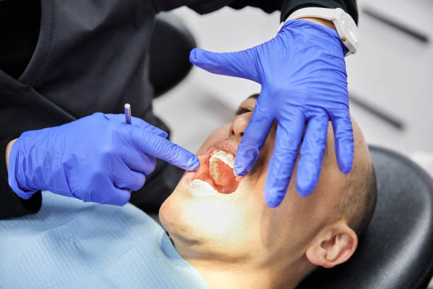 Best Tooth Pain Emergency Relief  in Choctaw Lake, OH